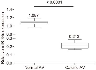 MicroRNA-34c Inhibits Osteogenic Differentiation and Valvular Interstitial Cell Calcification via STC1-Mediated JNK Pathway in Calcific Aortic Valve Disease